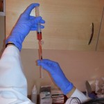 Terapia PRP (Platelet Rich Plasma)