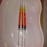 Terapia PRP (Platelet Rich Plasma)