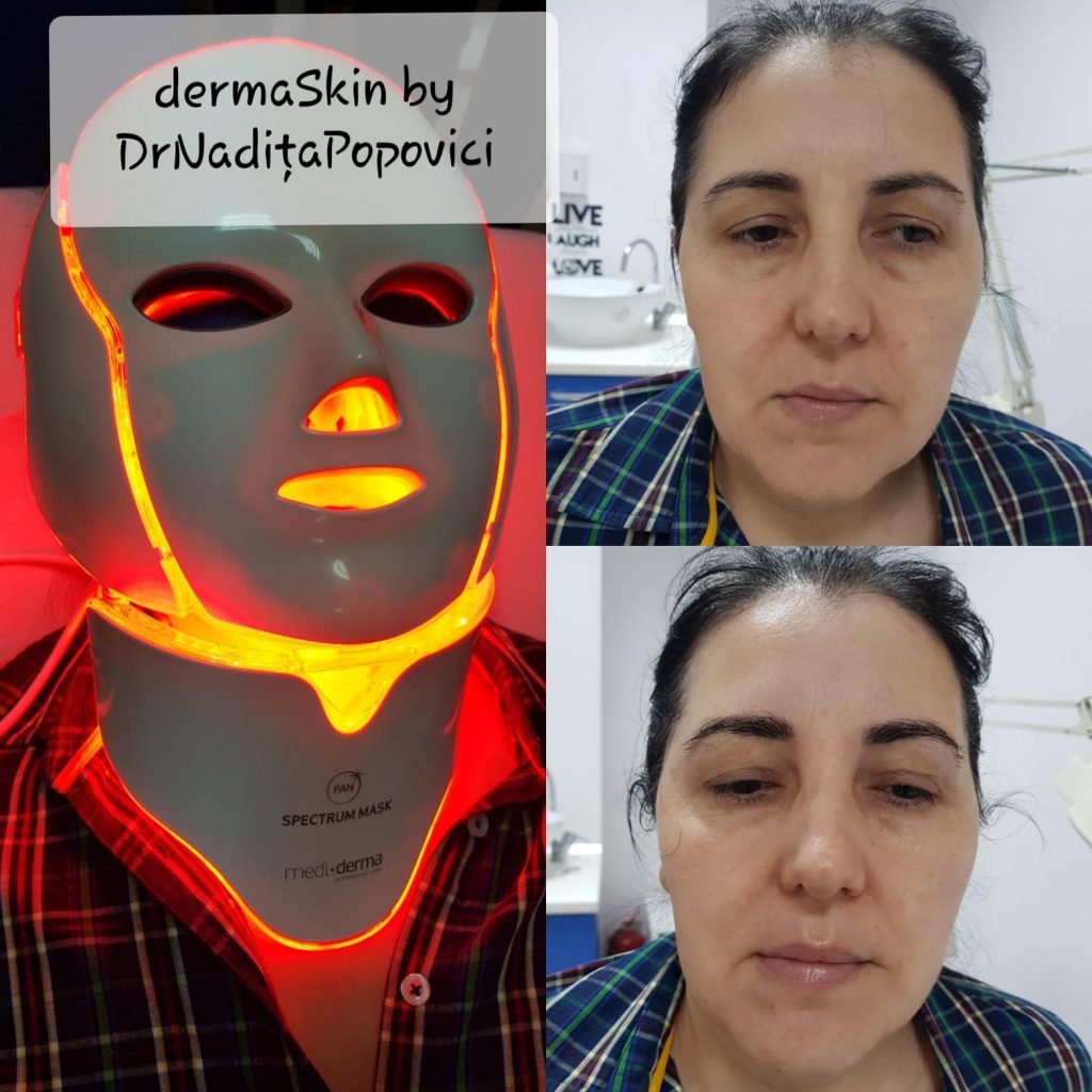 Spectrum Mask rezultate maxime intr-un timp mai scurt Spectrum Mask rezultate maxime intr-un timp mai scurt