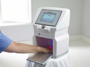 Laser LUNULA pentru Onicomicoza